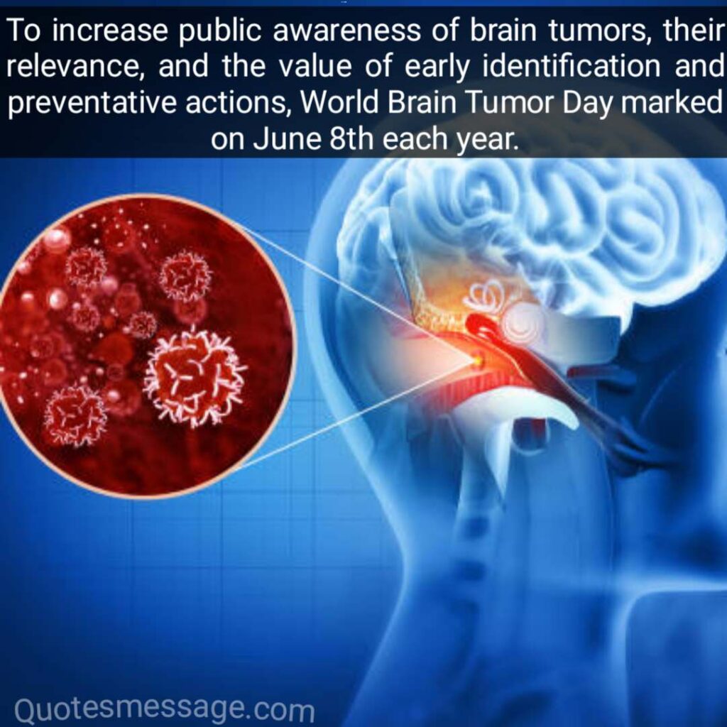 Brain Tumor Day