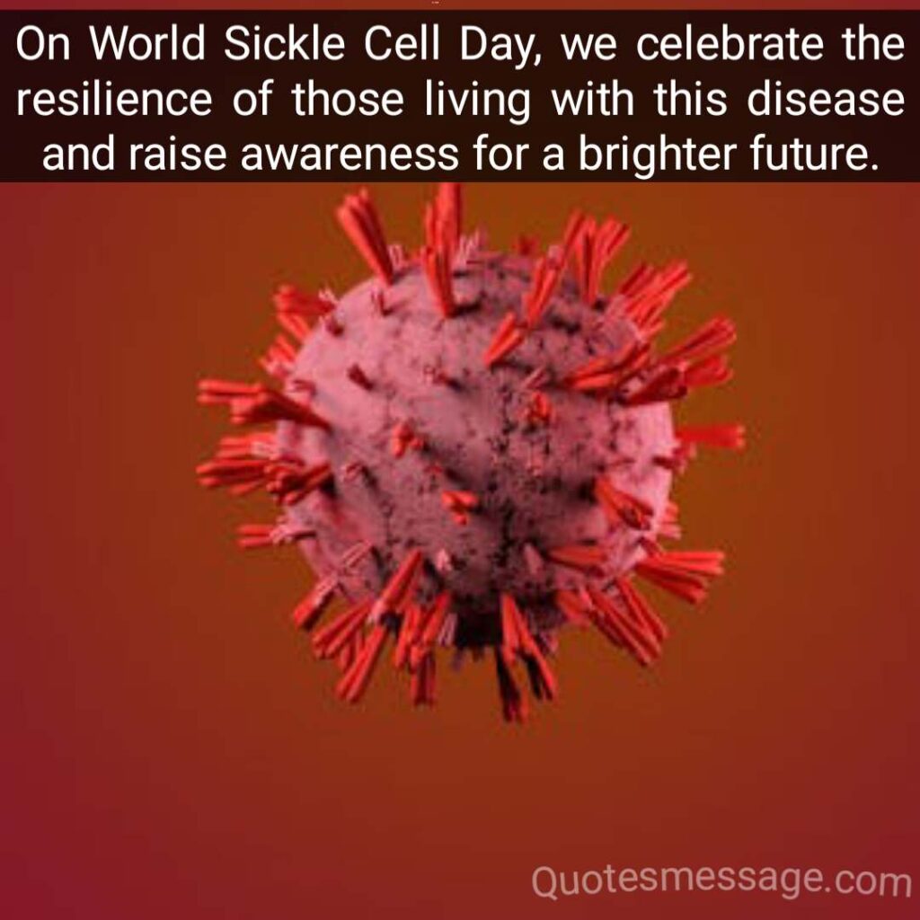 Sickle Cell Awarness Day